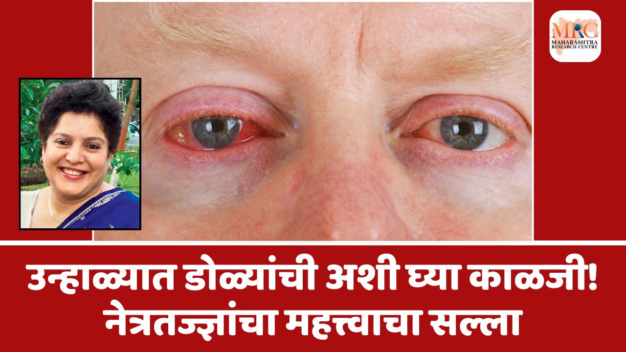 उन्हाळ्यात डोळ्यांची अशी घ्या काळजी! नेत्रतज्ज्ञांचा महत्त्वाचा सल्ला
